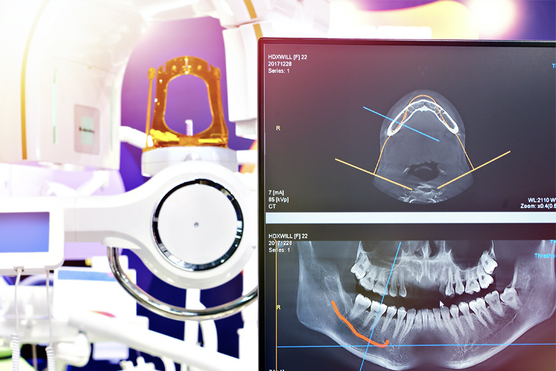 Digital Radiographs in 